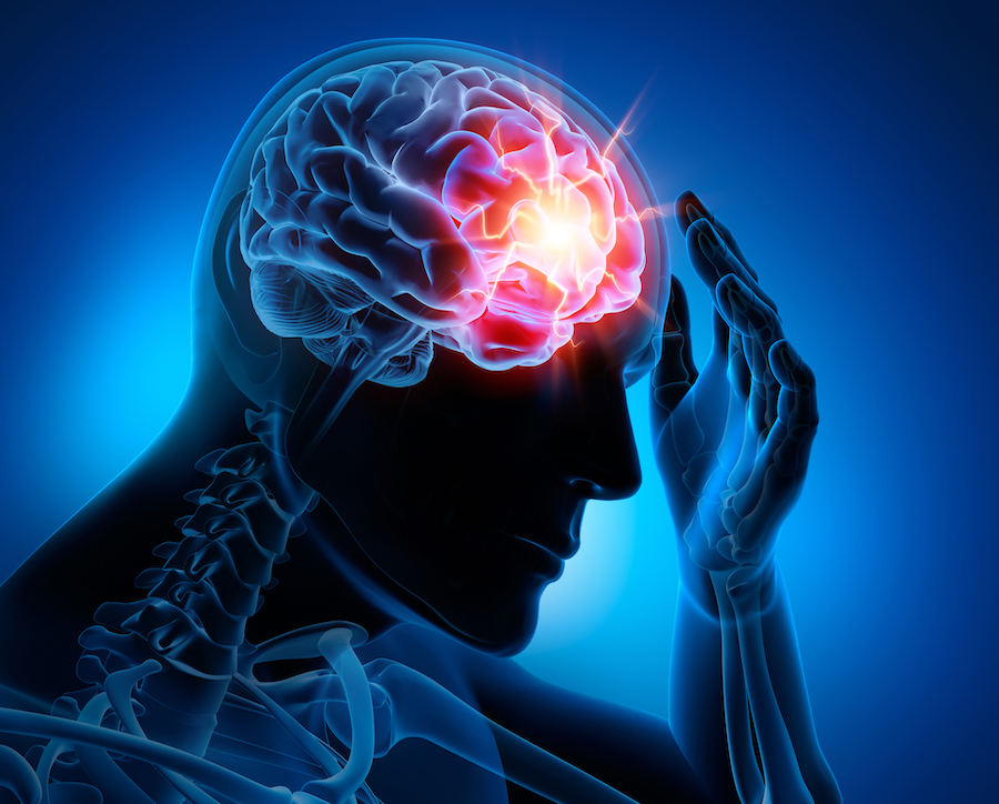 Delayed Concussion Symptoms